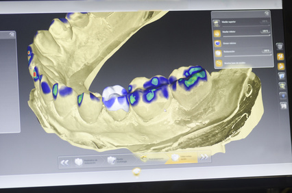 Aufnahme des Intraoralscanners [©sunlight 19, fotolia.com]